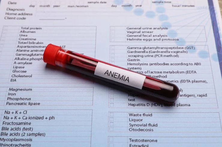 Anemia Profile-Advanced 1