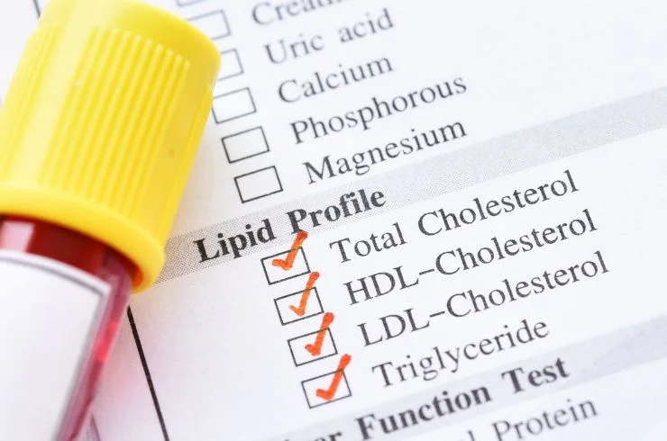 Lipid Profile 1