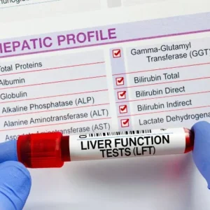 Liver Profile-Advanced 1