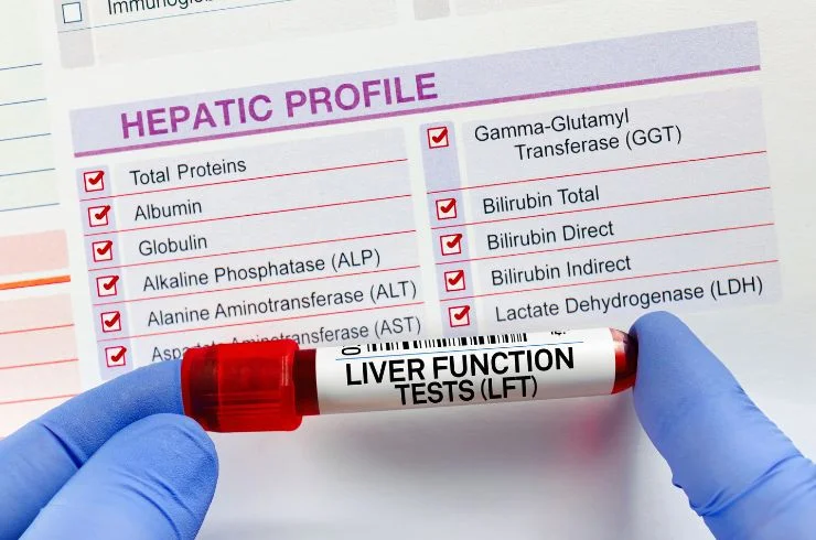 Liver Profile-Advanced 1