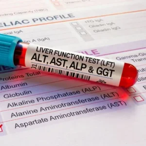 Liver Profile-Basic 1