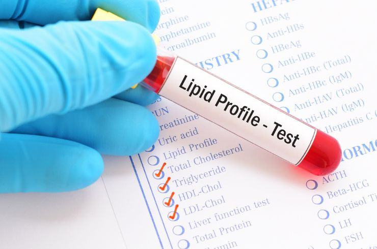 Lipid